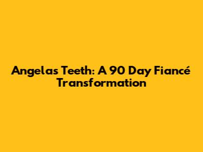 Angela's Teeth: A 90 Day Fiancé Transformation