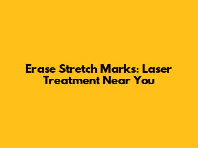 Erase Stretch Marks: Laser Treatment Near You