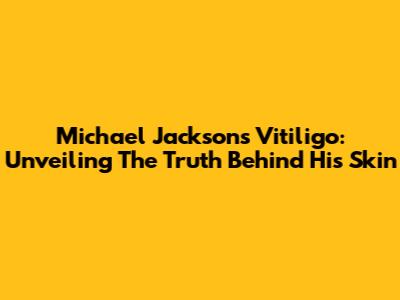 Michael Jackson's Vitiligo: Unveiling The Truth Behind His Skin