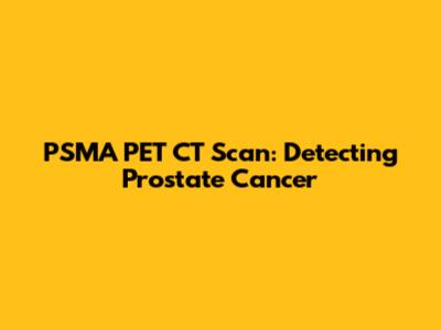 PSMA PET CT Scan: Detecting Prostate Cancer