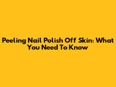 Peeling Nail Polish Off Skin: What You Need To Know