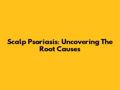 Scalp Psoriasis: Uncovering The Root Causes